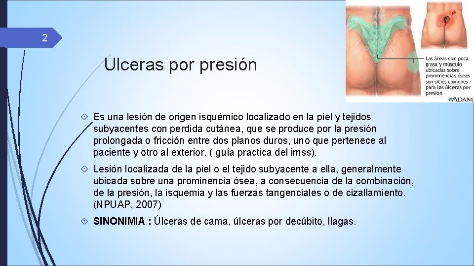 2 Ulceras por presión Es una lesión de origen isquémico localizado en la piel