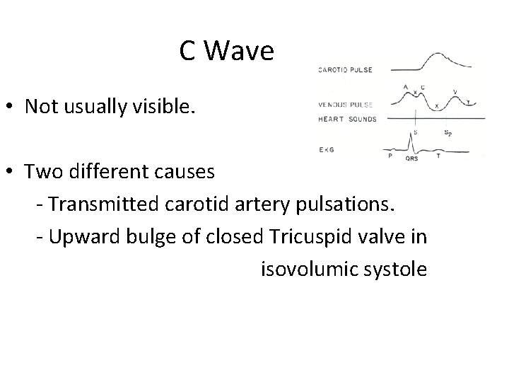 C Wave • Not usually visible. • Two different causes - Transmitted carotid artery