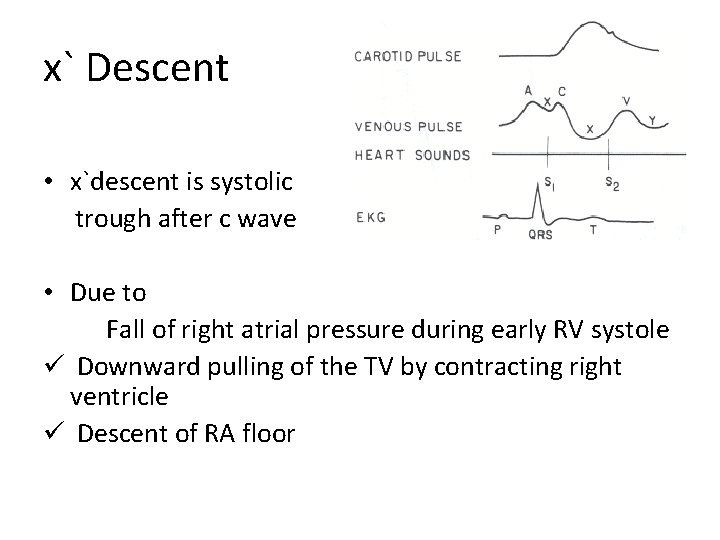 x` Descent • x`descent is systolic trough after c wave • Due to Fall
