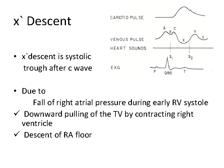 x` Descent • x`descent is systolic trough after c wave • Due to Fall x` Descent • x`descent is systolic trough after c wave • Due to Fall