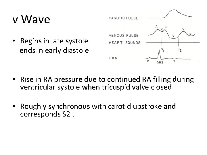 v Wave • Begins in late systole ends in early diastole • Rise in v Wave • Begins in late systole ends in early diastole • Rise in