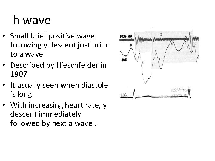 h wave • Small brief positive wave following y descent just prior to a