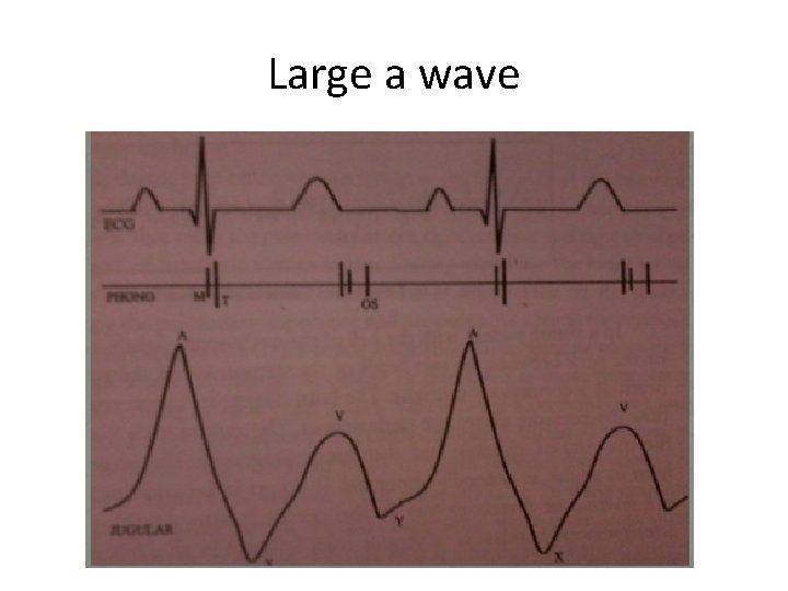 Large a wave 