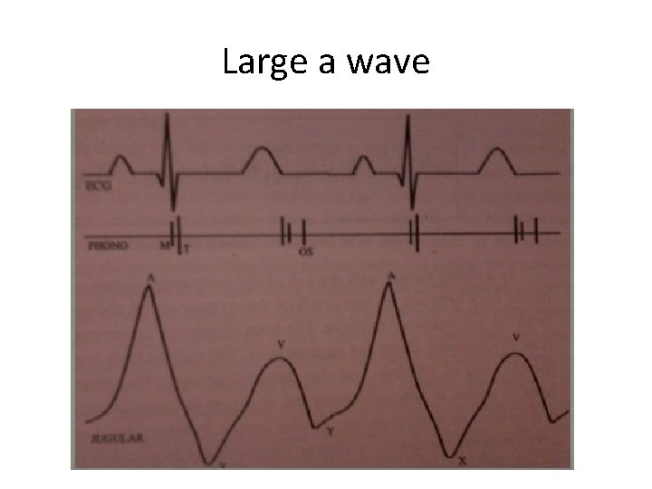 Large a wave Large a wave