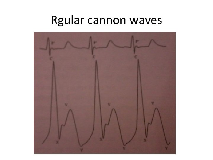 Rgular cannon waves 