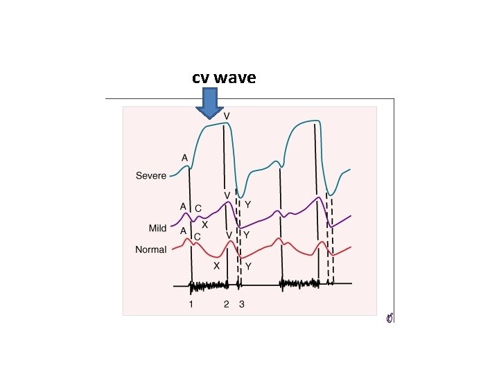 cv wave cv wave