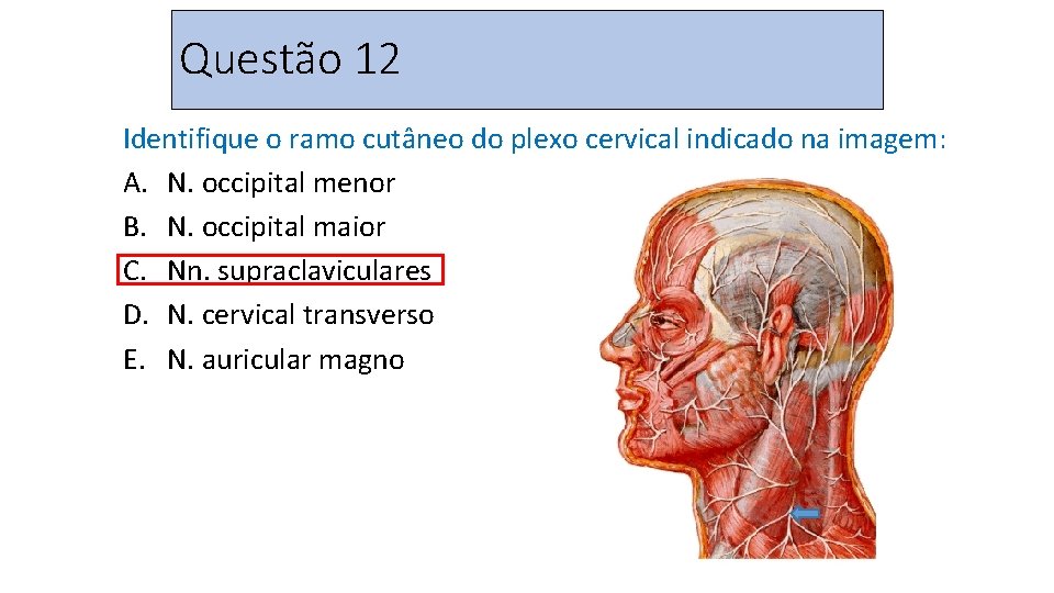 Questão 12 Identifique o ramo cutâneo do plexo cervical indicado na imagem: A. N.