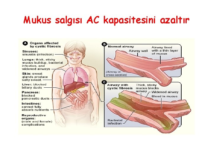 Mukus salgısı AC kapasitesini azaltır 