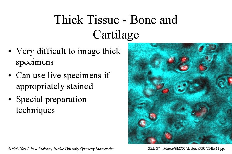 Thick Tissue - Bone and Cartilage • Very difficult to image thick specimens •