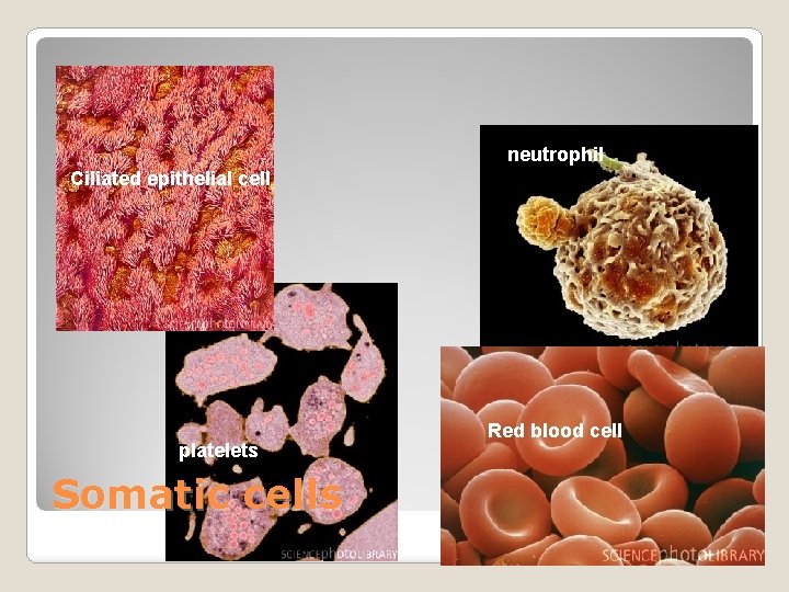 neutrophil Ciliated epithelial cell platelets Somatic cells Red blood cell 