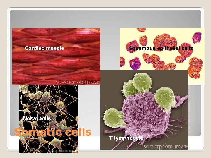 Cardiac muscle Squamous epithelial cells Nerve cells Somatic cells T lymphocyte 