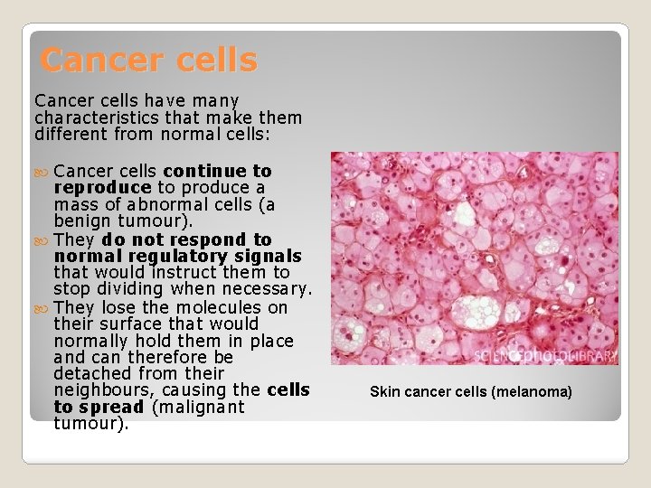 Cancer cells have many characteristics that make them different from normal cells: Cancer cells