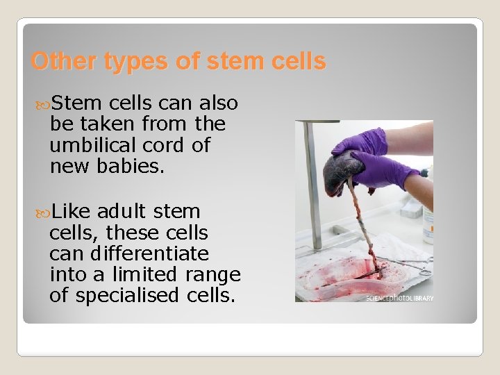 Other types of stem cells Stem cells can also be taken from the umbilical