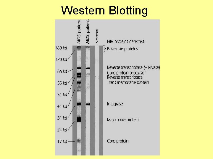 Western Blotting 