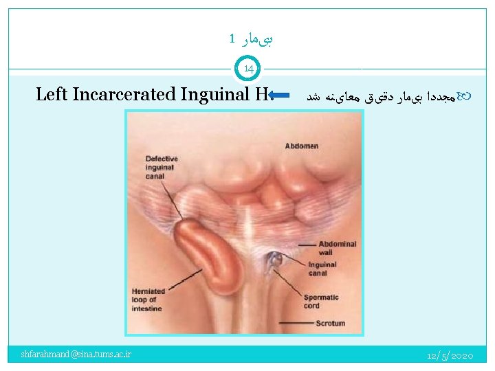 1 ﺑیﻤﺎﺭ 14 Left Incarcerated Inguinal H. shfarahmand@sina. tums. ac. ir ﻣﺠﺪﺩﺍ ﺑیﻤﺎﺭ ﺩﻗیﻖ