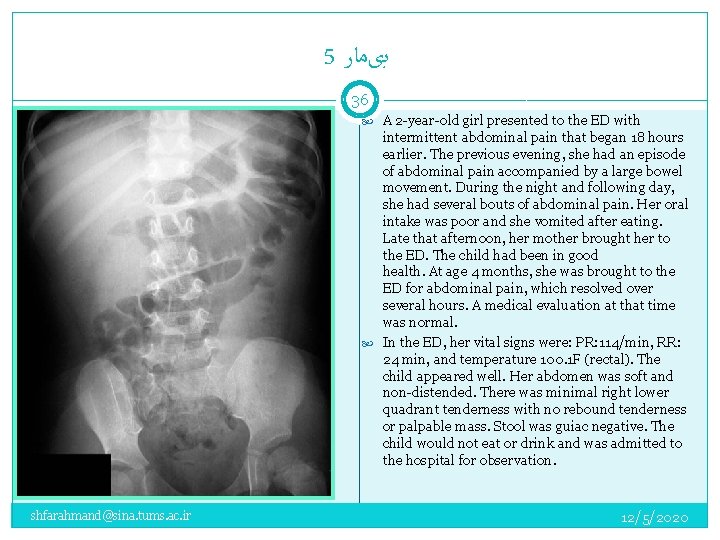 5 ﺑیﻤﺎﺭ 36 A 2 -year-old girl presented to the ED with intermittent abdominal