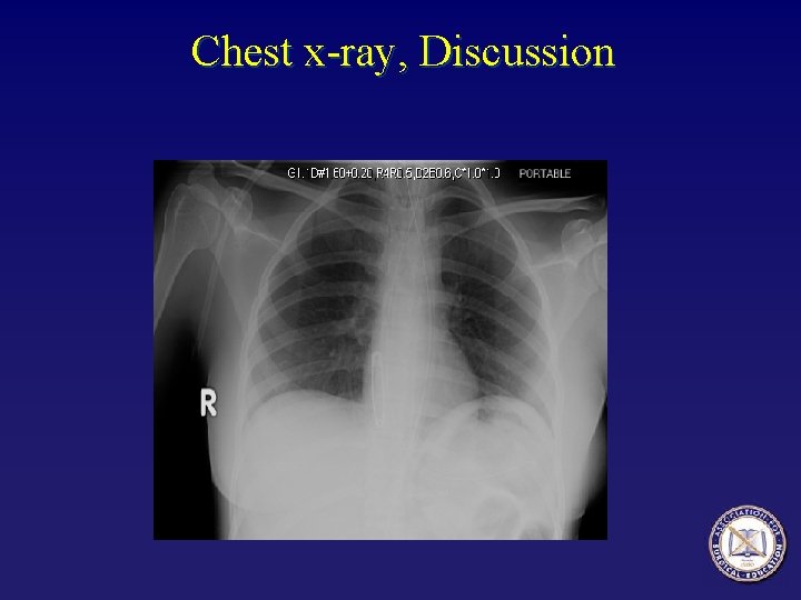 Chest x-ray, Discussion 