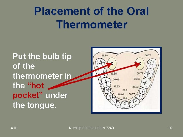 Placement of the Oral Thermometer Put the bulb tip of thermometer in the “hot