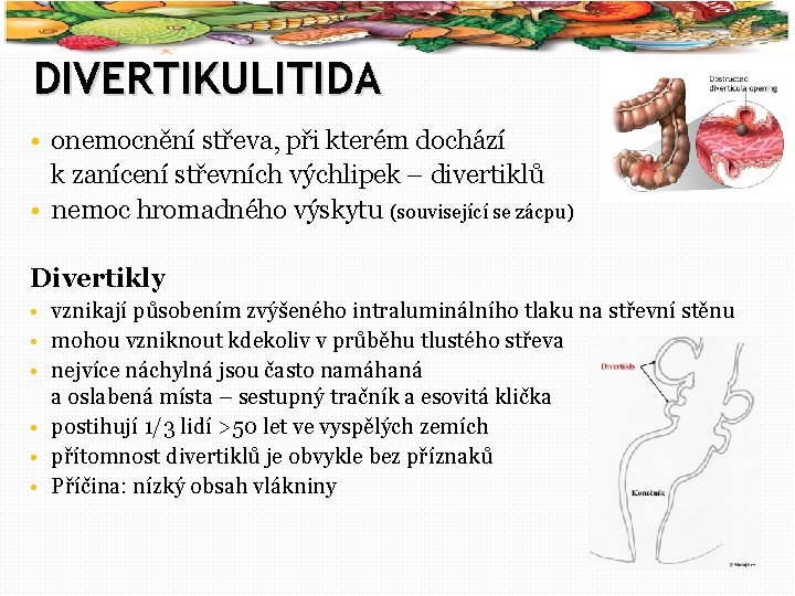 56 DIVERTIKULITIDA • onemocnění střeva, při kterém dochází k zanícení střevních výchlipek – divertiklů