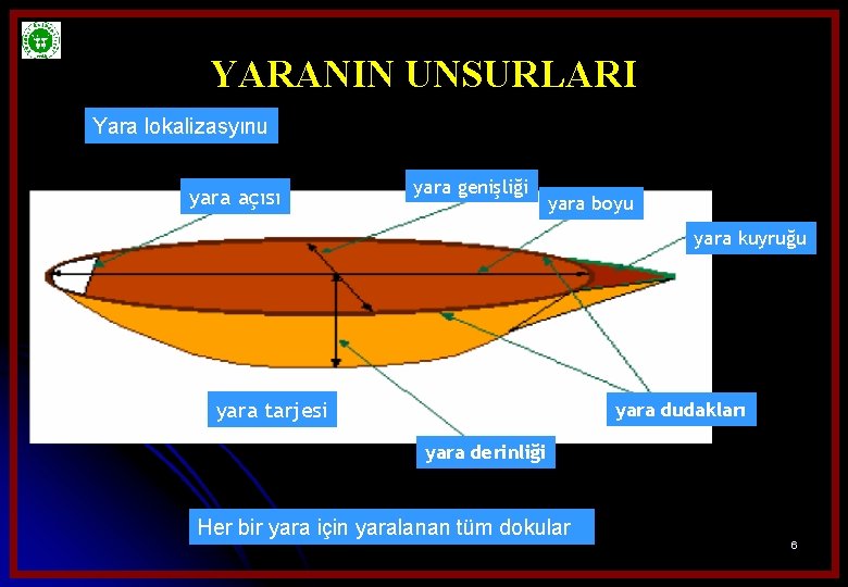 YARANIN UNSURLARI Yara lokalizasyınu yara açısı yara genişliği yara boyu yara kuyruğu yara tarjesi