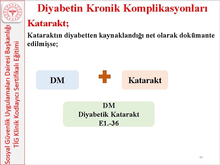 Diyabetin Kronik Komplikasyonları Katarakt; Kataraktın diyabetten kaynaklandığı net olarak dokümante edilmişse; DM Katarakt DM