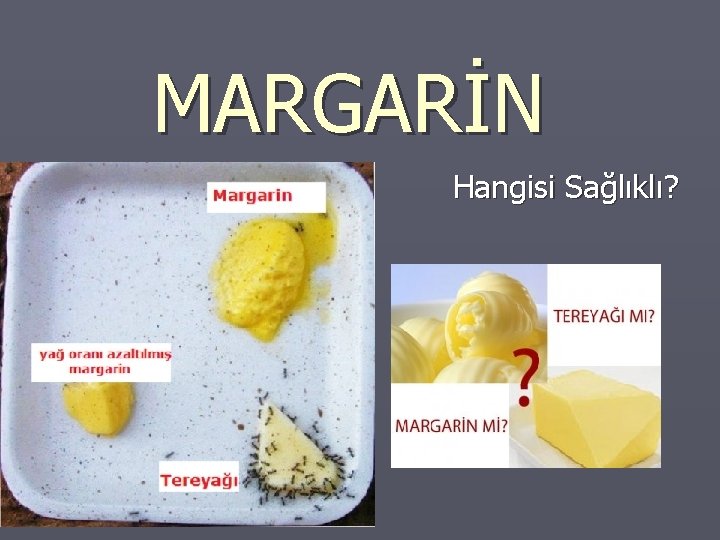 MARGARİN Hangisi Sağlıklı? 