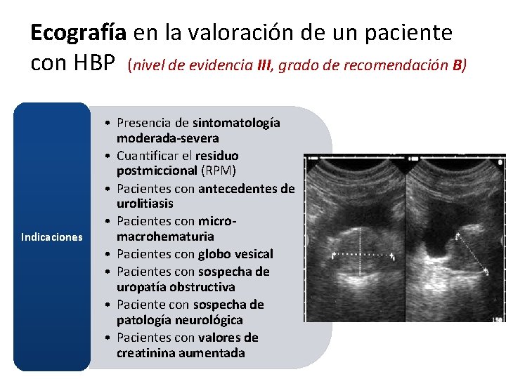 Ecografía en la valoración de un paciente con HBP (nivel de evidencia III, grado