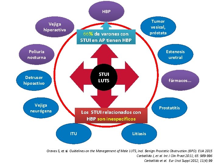 HBP Vejiga hiperactiva Tumor vesical, próstata 66% de varones con STUI en AP tienen