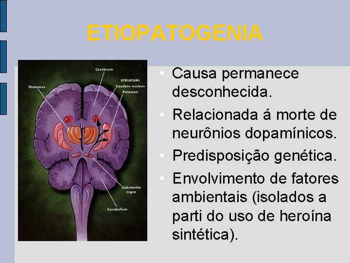 ETIOPATOGENIA • Causa permanece desconhecida. • Relacionada á morte de neurônios dopamínicos. • Predisposição ETIOPATOGENIA • Causa permanece desconhecida. • Relacionada á morte de neurônios dopamínicos. • Predisposição