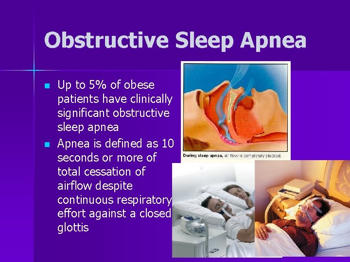 Obstructive Sleep Apnea n n Up to 5% of obese patients have clinically significant