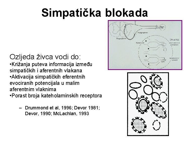 Simpatička blokada Ozljeda živca vodi do: • Križanja puteva informacija između simpatičkih i aferentnih