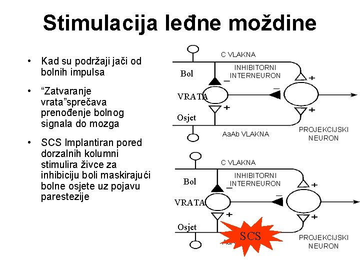 Stimulacija leđne moždine • Kad su podržaji jači od bolnih impulsa • “Zatvaranje vrata”sprečava