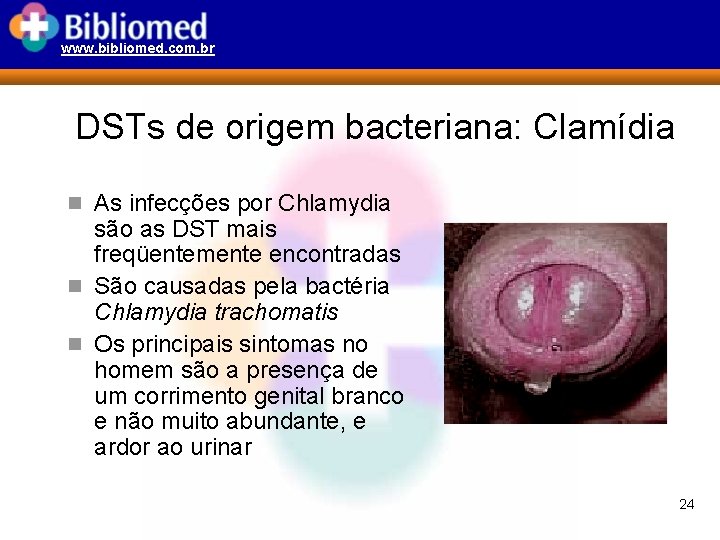 www. bibliomed. com. br DSTs de origem bacteriana: Clamídia n As infecções por Chlamydia