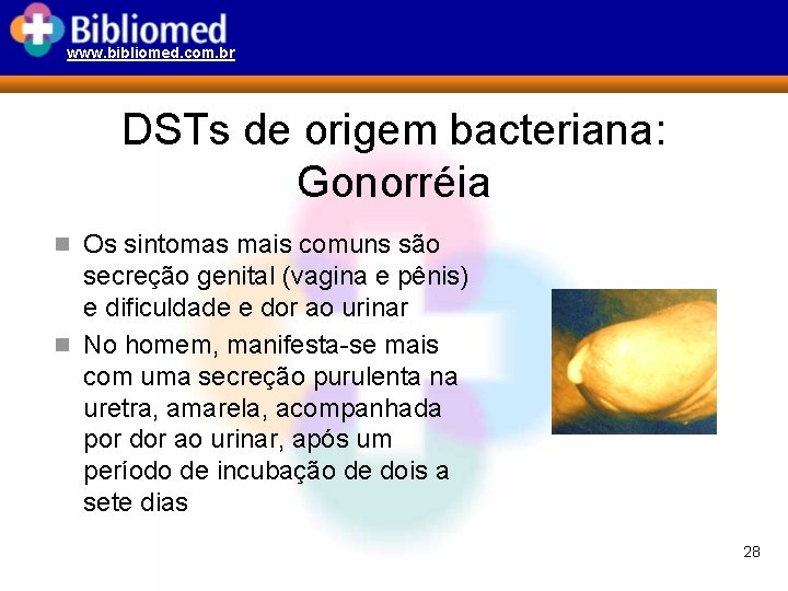 www. bibliomed. com. br DSTs de origem bacteriana: Gonorréia n Os sintomas mais comuns
