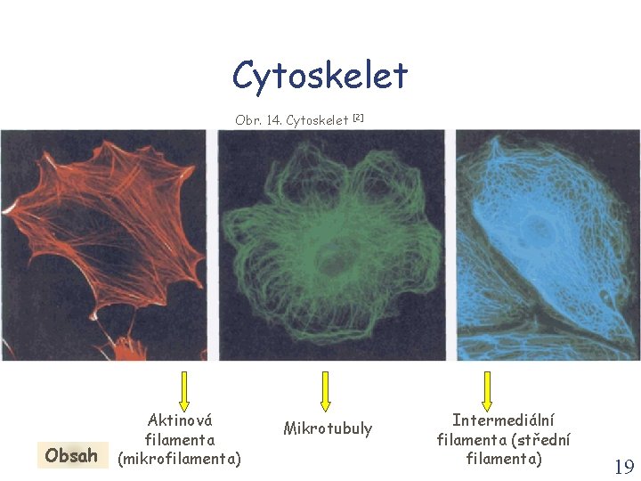 Cytoskelet Obr. 14. Cytoskelet Obsah Aktinová filamenta (mikrofilamenta) [2] Mikrotubuly Intermediální filamenta (střední filamenta)