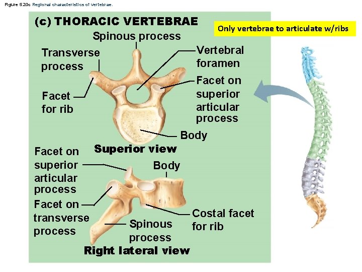 Figure 5. 20 c Regional characteristics of vertebrae. (c) THORACIC VERTEBRAE Only vertebrae to