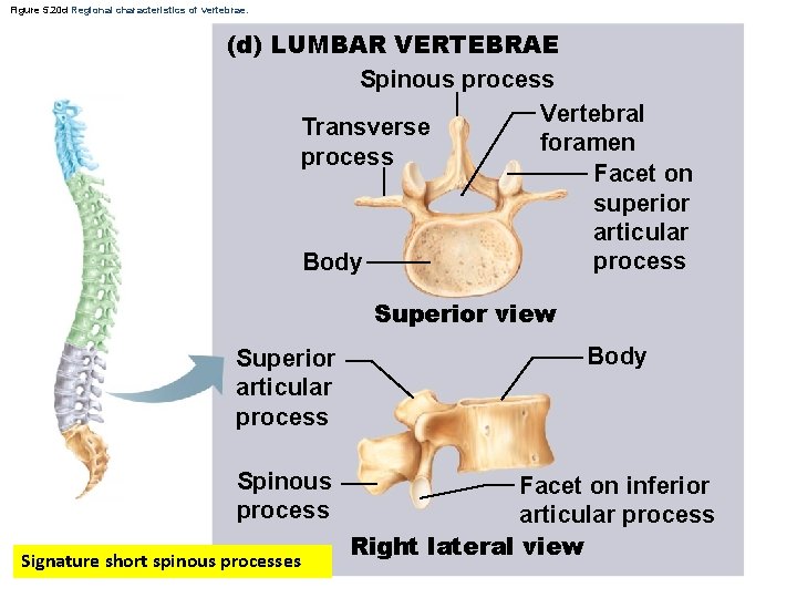 Figure 5. 20 d Regional characteristics of vertebrae. (d) LUMBAR VERTEBRAE Spinous process Vertebral