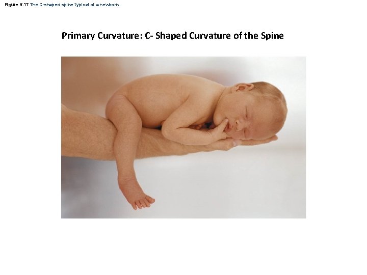 Figure 5. 17 The C-shaped spine typical of a newborn. Primary Curvature: C- Shaped Figure 5. 17 The C-shaped spine typical of a newborn. Primary Curvature: C- Shaped