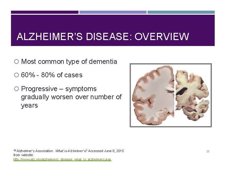 ALZHEIMER’S DISEASE: OVERVIEW Most common type of dementia 60% - 80% of cases Progressive