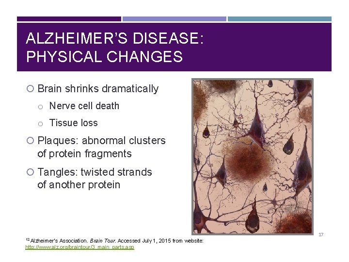 ALZHEIMER’S DISEASE: PHYSICAL CHANGES Brain shrinks dramatically o Nerve cell death o Tissue loss
