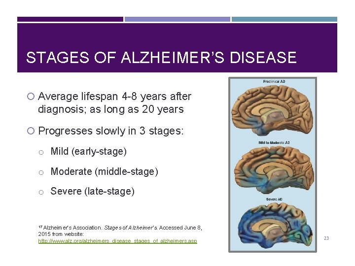 STAGES OF ALZHEIMER’S DISEASE Average lifespan 4 -8 years after diagnosis; as long as