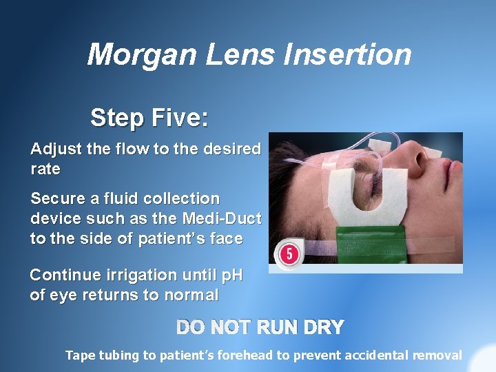 Morgan Lens Insertion Step Five: Adjust the flow to the desired rate Secure a