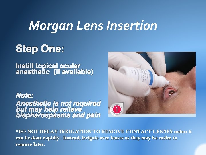 Morgan Lens Insertion Step One: Instill topical ocular anesthetic (if available) Note: Anesthetic is