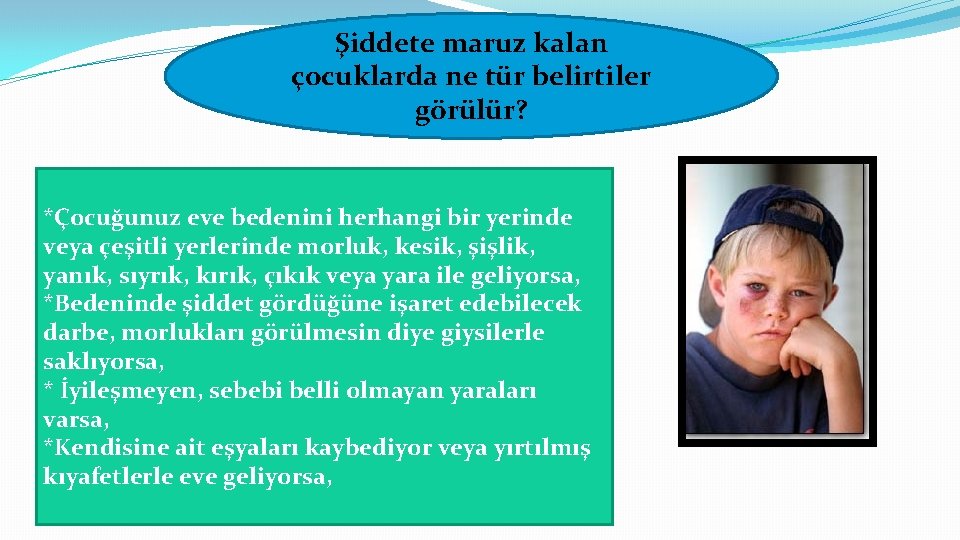 Şiddete maruz kalan çocuklarda ne tür belirtiler görülür? *Çocuğunuz eve bedenini herhangi bir yerinde