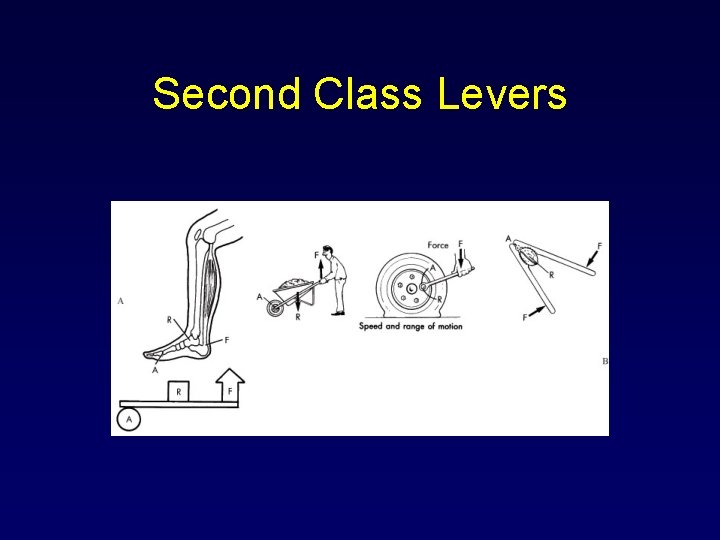 Second Class Levers 