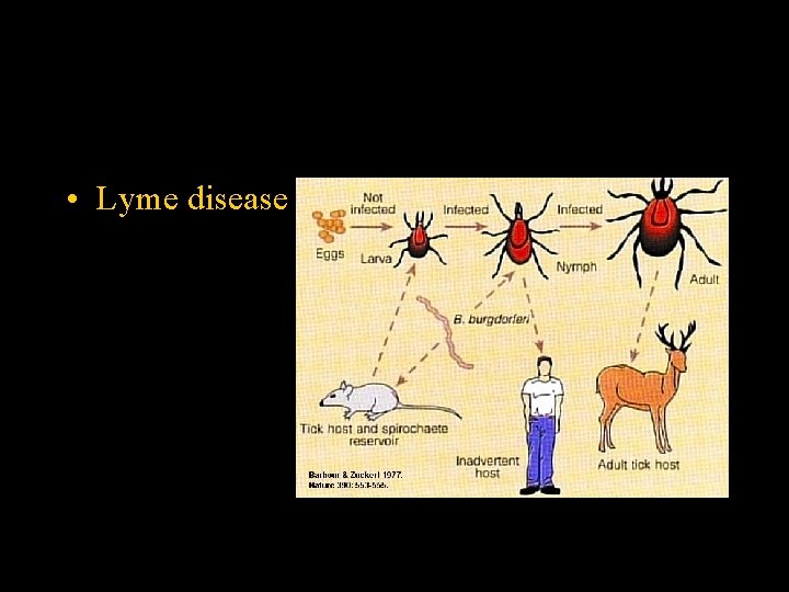  • Lyme disease 