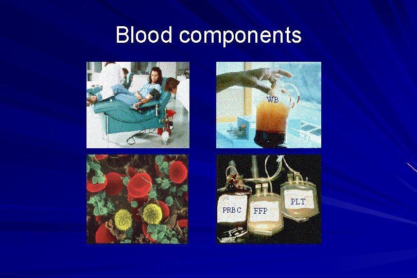 Blood components WB PLT PRBC FFP 