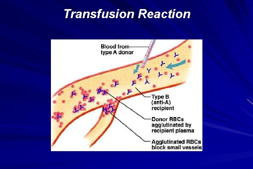 Transfusion Reaction 