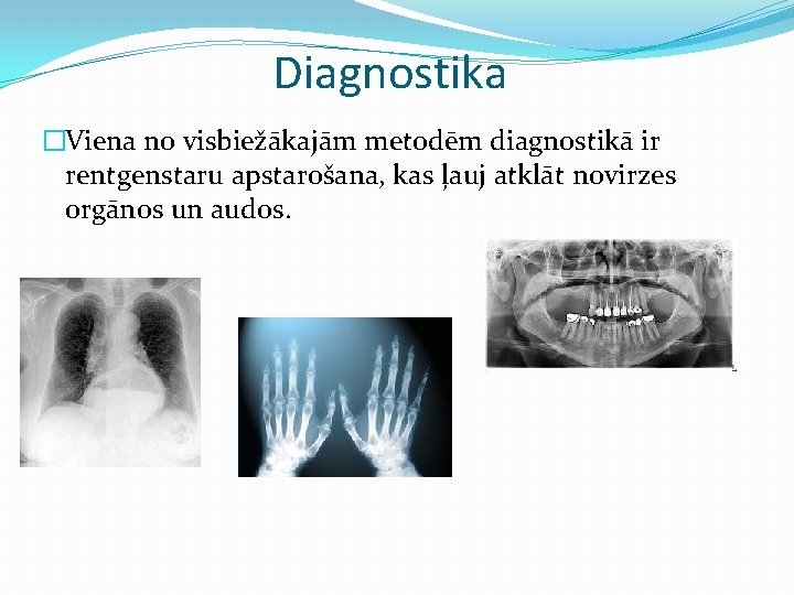 Diagnostika �Viena no visbiežākajām metodēm diagnostikā ir rentgenstaru apstarošana, kas ļauj atklāt novirzes orgānos