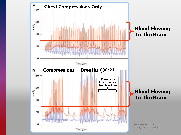 Chest Compressions Only Blood Flowing To The Brain Compressions + Breaths (30: 2) Pausing
